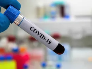 «Covid-19 – как это было»