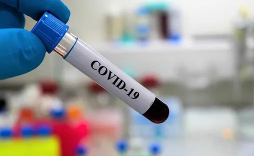 «Covid-19 – как это было»